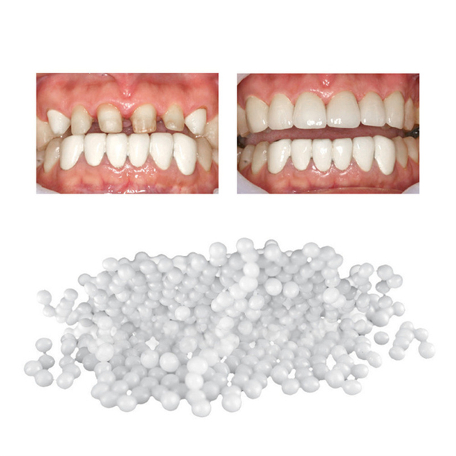 Crazylife Moldable Solid Gum Particles Modified Teeth Temporary Filling Cavity Denture Gap Filling Gel