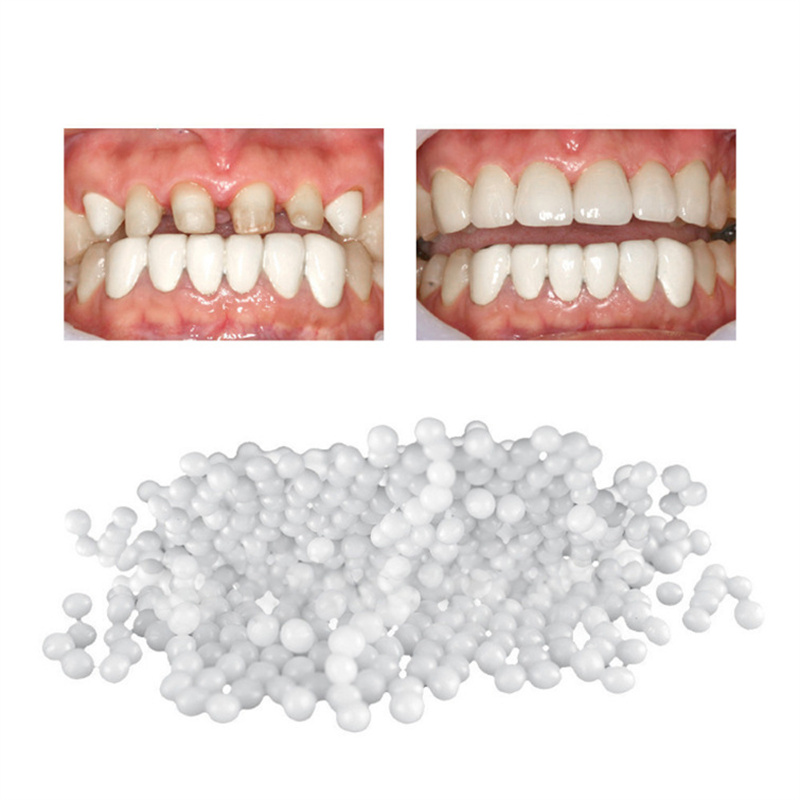 Crazylife Moldable Solid Gum Particles Modified Teeth Temporary Filling Cavity Denture Gap Filling Gel