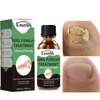 Crazylife Extra Strong Nail Fungus Treatment Serum Essence oil Repair Removal Fungal Feet Nails Care Toe Anti Infection Cream Essence