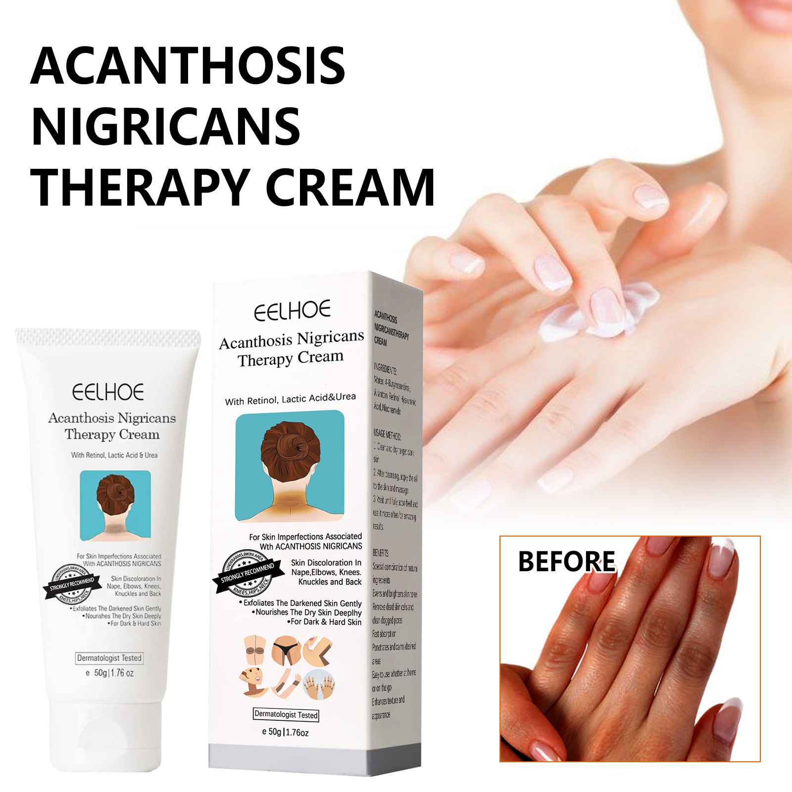 Black Scaly Skin Repair Cream - Moisturizing, Whitening and Repairing Cream for Underarms, Arms, Knees and Joints to Remove Dark Spots on the Body