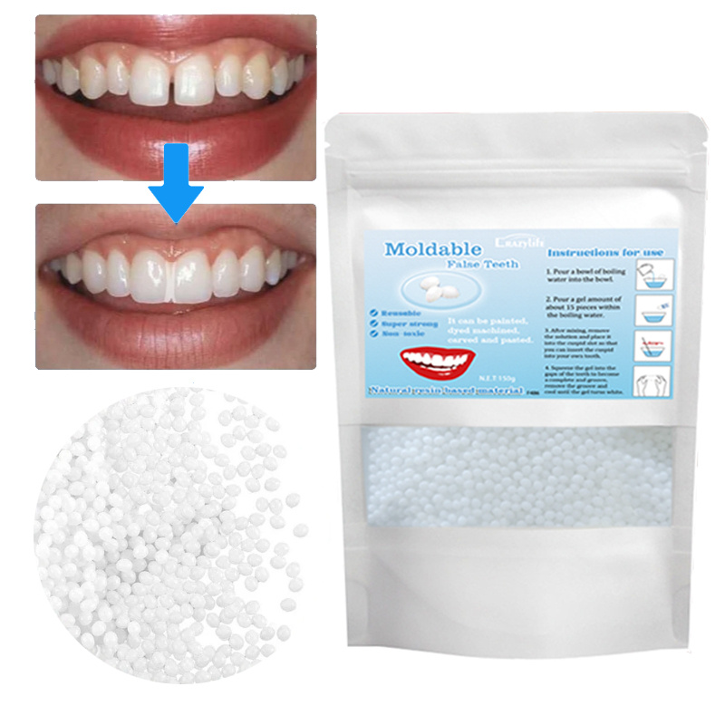 Crazylife Denture Adhesive Cream | Temporary Tooth Repair Kit for Gaps, Loose Dentures & Broken Teeth | Dental Resin Glue for Emergency False Teeth Repair