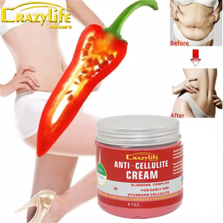 Crazylife Fat Removal Cream - Weight Loss Cream - Say Goodbye to Fat! New-style Healthy Weight Loss