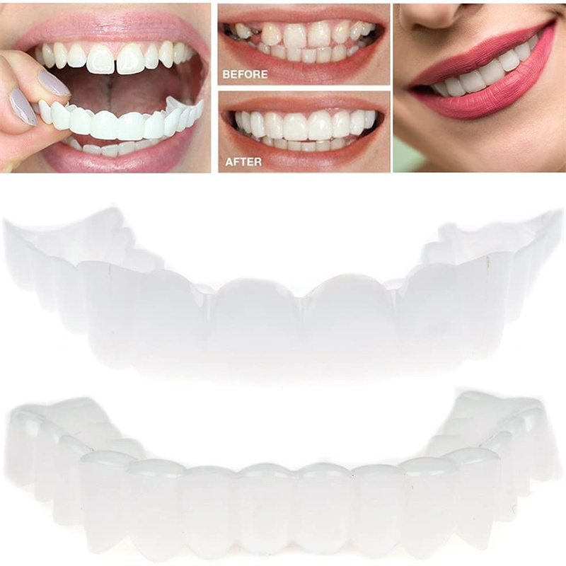 Crazylife Blue Teeth Straightener Kit - Removable Upper & Lower Dental Aligners, Orthodontic Retainer for Adults And Teens, Adjustable Fake Teeth for Comfortable Fit