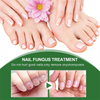 Crazylife Extra Strong Nail Fungus Treatment Serum Essence oil Repair Removal Fungal Feet Nails Care Toe Anti Infection Cream Essence