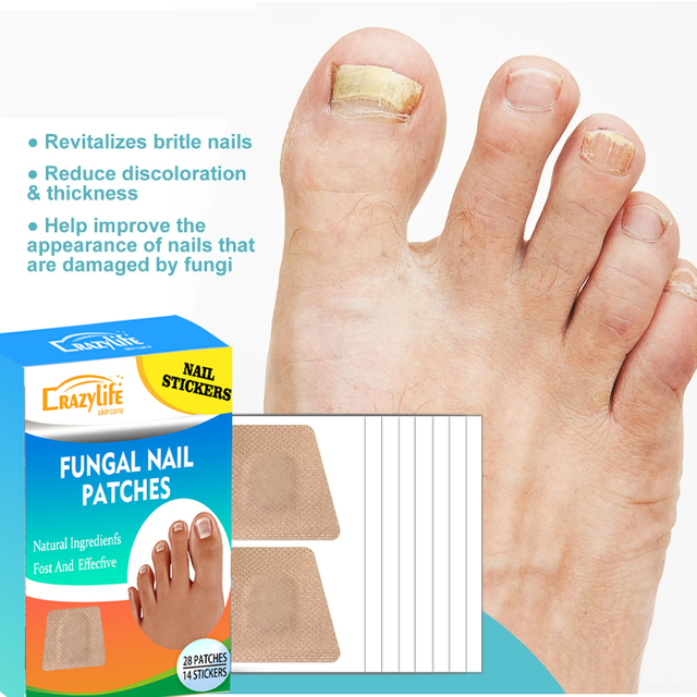 Crazylife 28Pcs Toenail Fungus Patch Nail Repair Patches Nail Ingrown Correction Sticker Discolored Damaged Nails Foot Care Tool Uñas