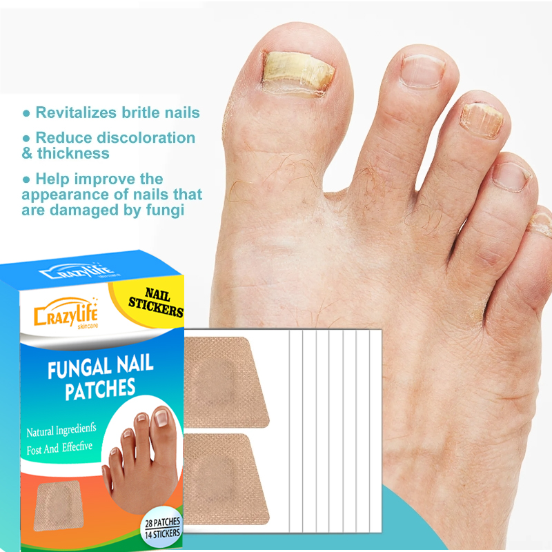 Crazylife 28Pcs Toenail Fungus Patch Nail Repair Patches Nail Ingrown Correction Sticker Discolored Damaged Nails Foot Care Tool Uñas