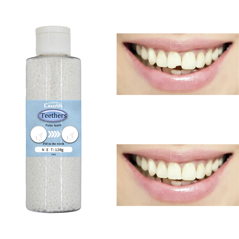 Crazylife Dental Repair Kit Temporary Tooth Filling - Instant Pain Relief for Cracked Tooth, Cavities, Lost Filling & Gaps | Strong Putty for Dentures, Crowns & Loose Teeth | Emergency Repair Solution