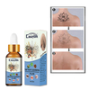 Quick Tattoo Removal Serum Permanent Tattoo Remover Liquid Natural Painless Body Facial Pigment Fading Cleaning Skin Care