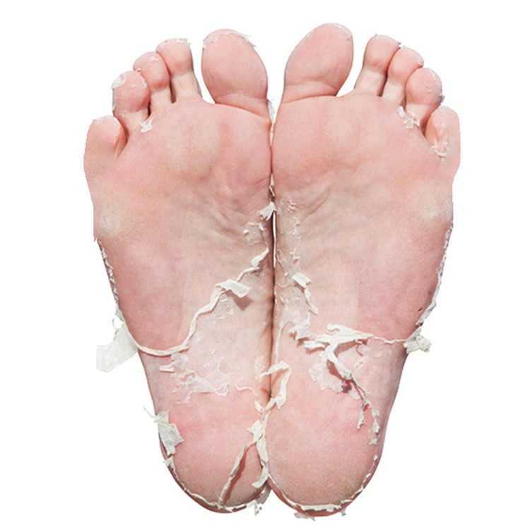 Exfoliating Foot Mask Feet Pedicure Remove Dead Skin Moisturizing Foot Exfoliator Feet Masks Skin Care