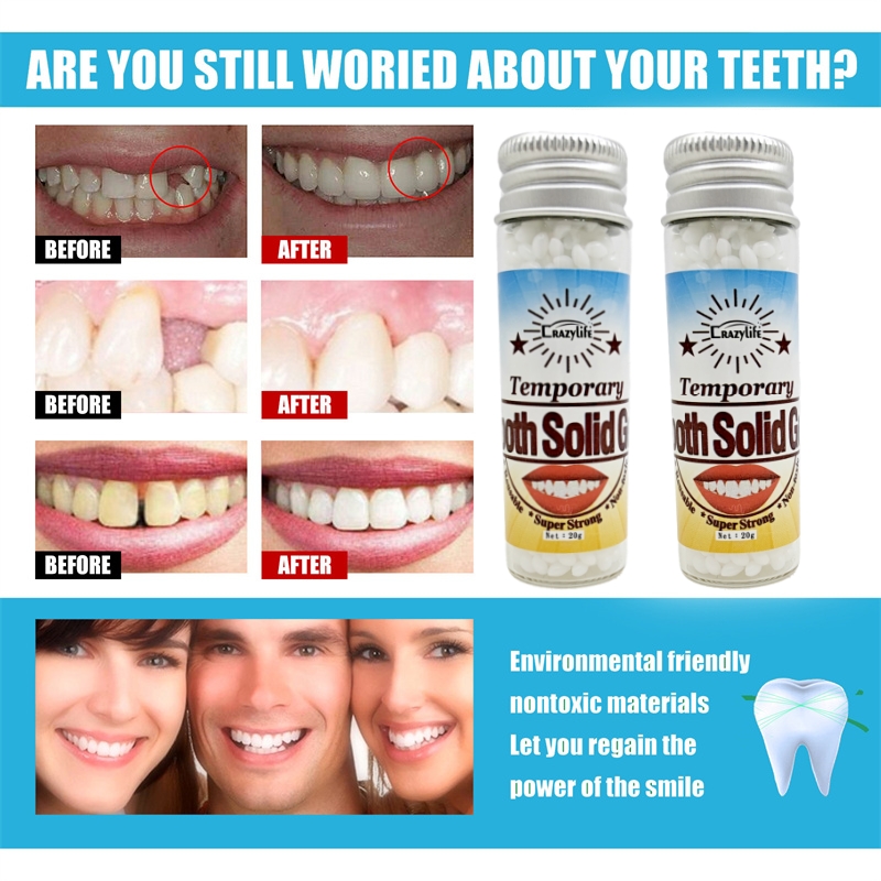 Crazylife Moldable Solid Gum Particles Modified Teeth Temporary Filling Cavity Denture Gap Filling Gel