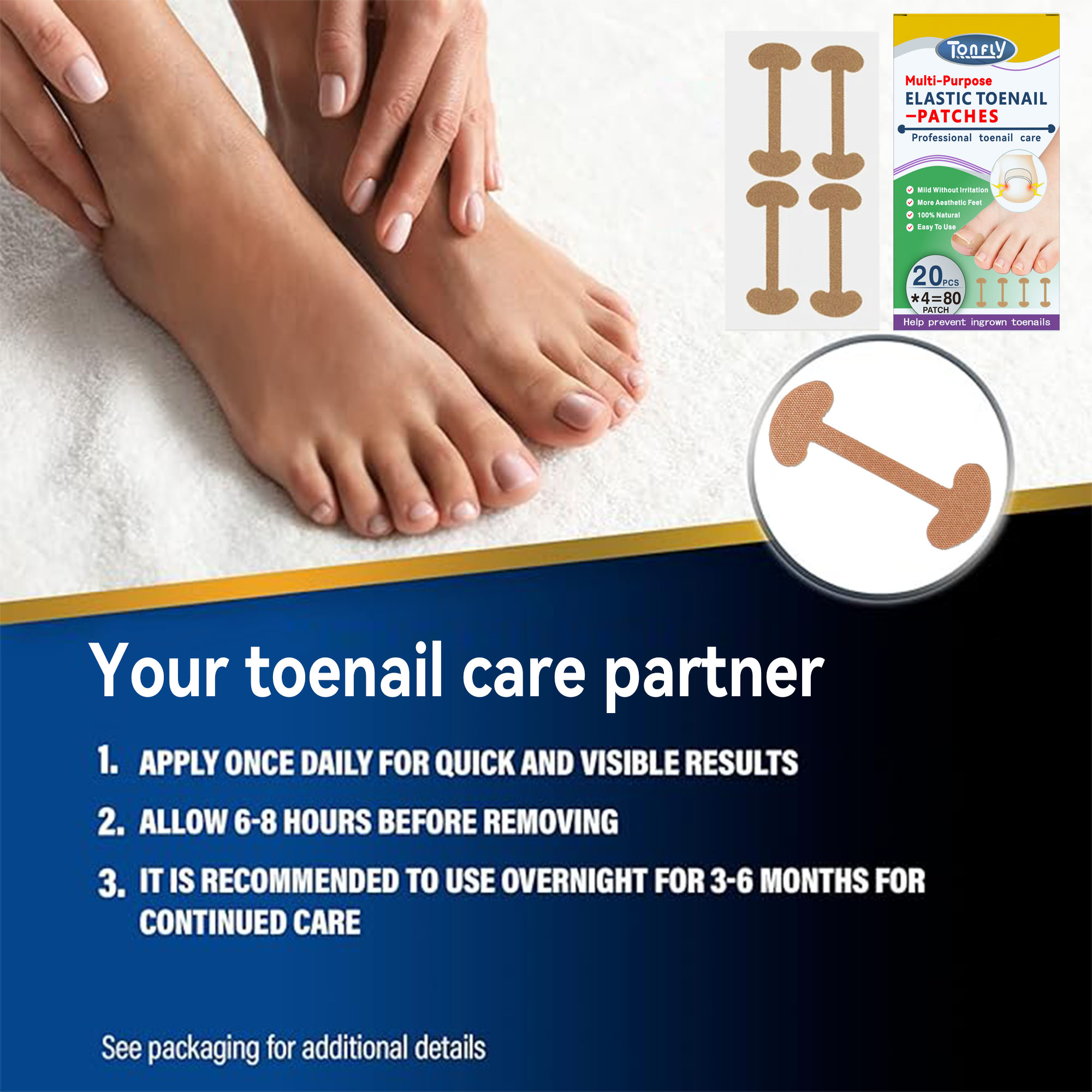  Tonfly Ingrown Toenail Paronychia Treatment Foot Corrector Stickers Toe Nail Repair