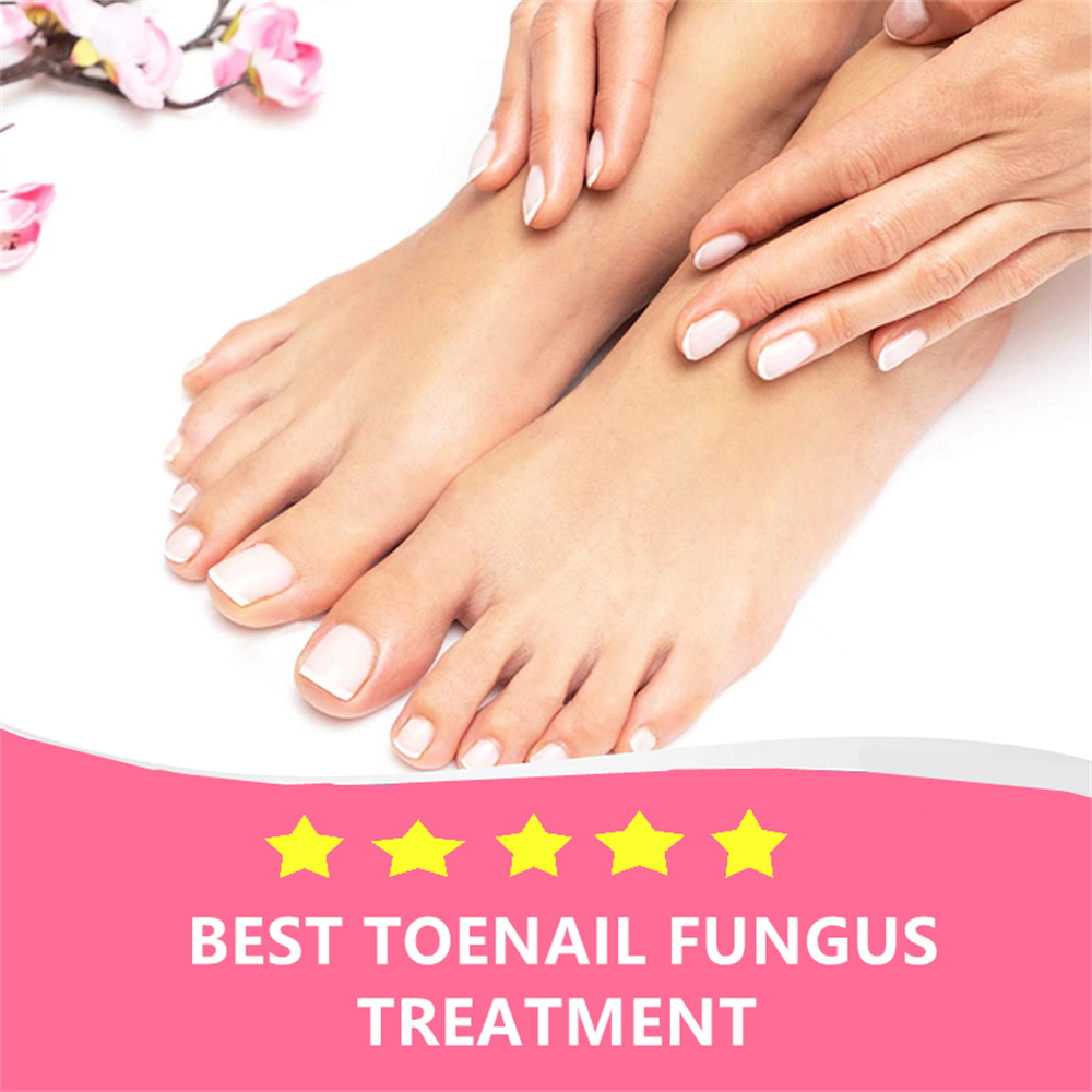 Blsex Nail Fungal Repair Serum Foot Toe Nail Fungus Removal Essential Oil Anti Infection Onychomycosis Paronychia Repairing Care