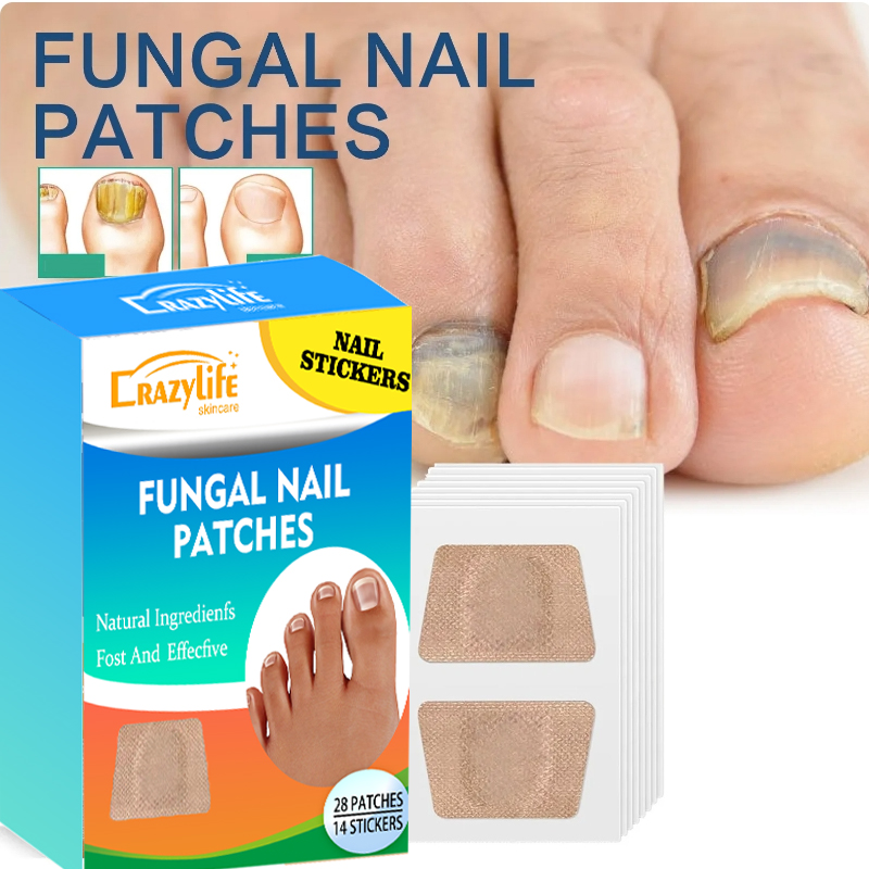 Crazylife 28Pcs Toenail Fungus Patch Nail Repair Patches Nail Ingrown Correction Sticker Discolored Damaged Nails Foot Care Tool Uñas