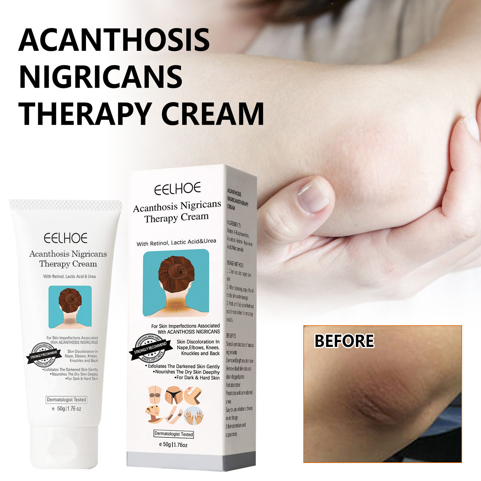 Black Scaly Skin Repair Cream - Moisturizing, Whitening and Repairing Cream for Underarms, Arms, Knees and Joints to Remove Dark Spots on the Body