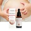 StretchMarkCreamNATURALFORMULA - Natural formula oil for reducing and smoothing pregnancy stretch marks, providing firming effect.