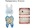 Crazylife Dental Material Temporary Crown Oral Cavity Porcelain Teeth Temporary Crown Dental Veneer Dentures Anterior Teeth Posterior Teeth Crowns