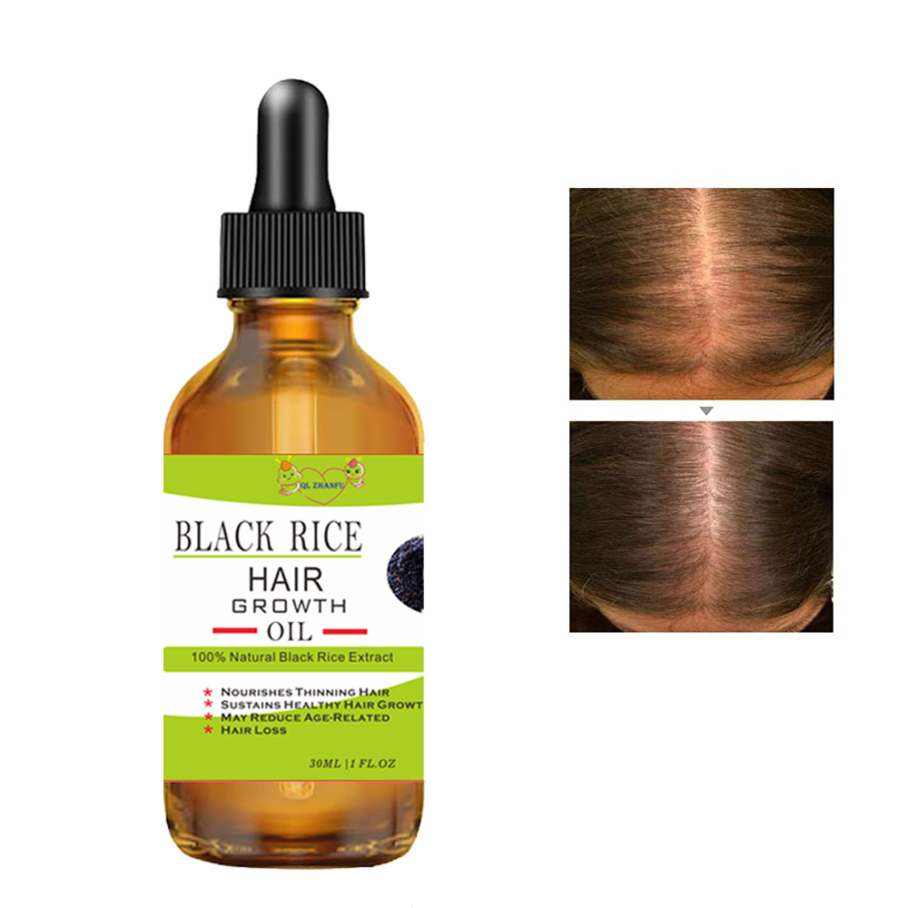 Hair Growth Serum Black Rice Rosemary for Hair Loss Treatment Bald Head Hair Regrowth Black Sesame Seeds Essence 30ml