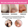 Charcoal & Tea Tree Nose Pore Strip - Blackhead Extractor Deep Cleans Non-Irritating