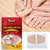 Tonfly Ingrown Toenail Correction Tool Nail Filling Pad Ingrown Toe Nail Treatment Elastic Patch Straightening Clip Brace Pedicure Tool