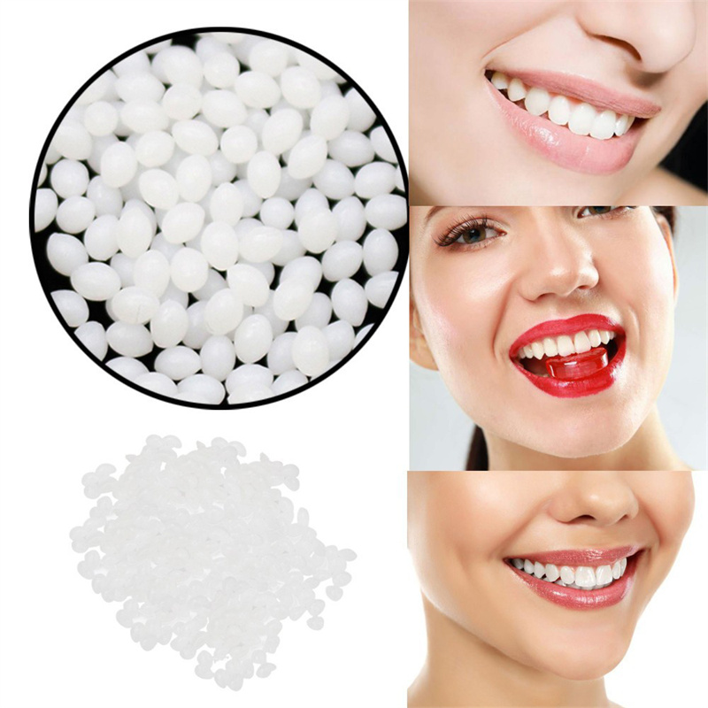 Crazylife Temporary Dental Repair Clay - Instant Tooth Filling Kit for Cavities, Gaps, Cracked Teeth & Dentures | Moldable Solid Dental Wax for Emergency, Parties & Travel | Pain Relief & Smile Reshap