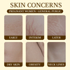 Stretch mark oil 120ml