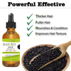 Hair Growth Serum Black Rice Rosemary for Hair Loss Treatment Bald Head Hair Regrowth Black Sesame Seeds Essence 30ml