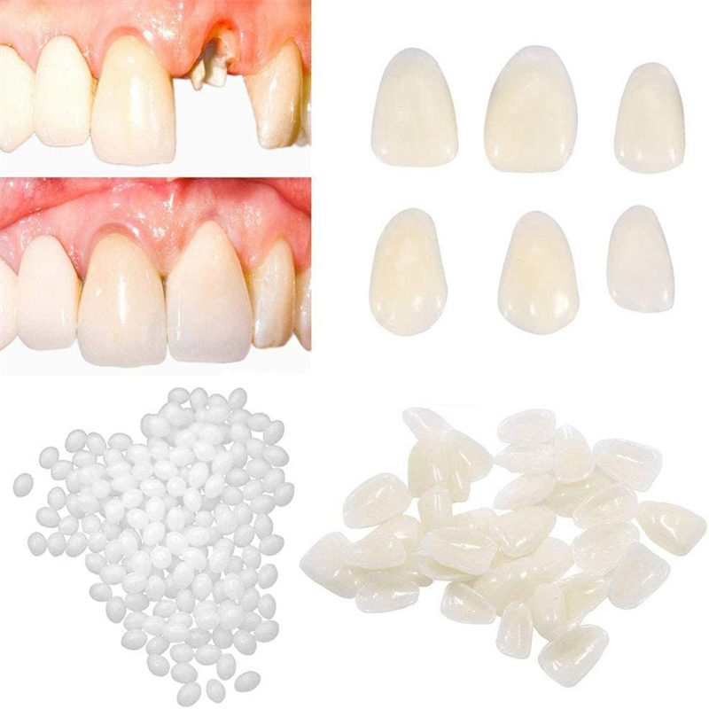 Crazylife Temporary dental crown, filling material, teeth care before and after treatment