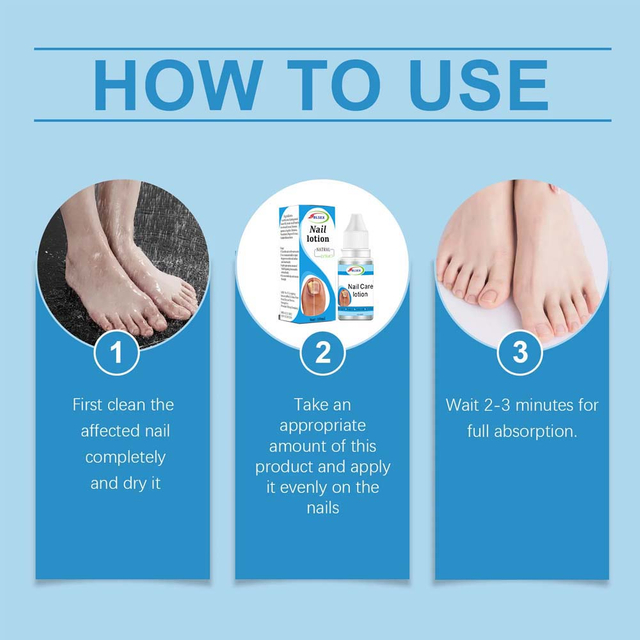  BLSEX Uñas Fungus Nails Treatment for Fingernails Toenails Repair Onychomycosis Paronychia Anti Infection Toe Nail Fungal Removal