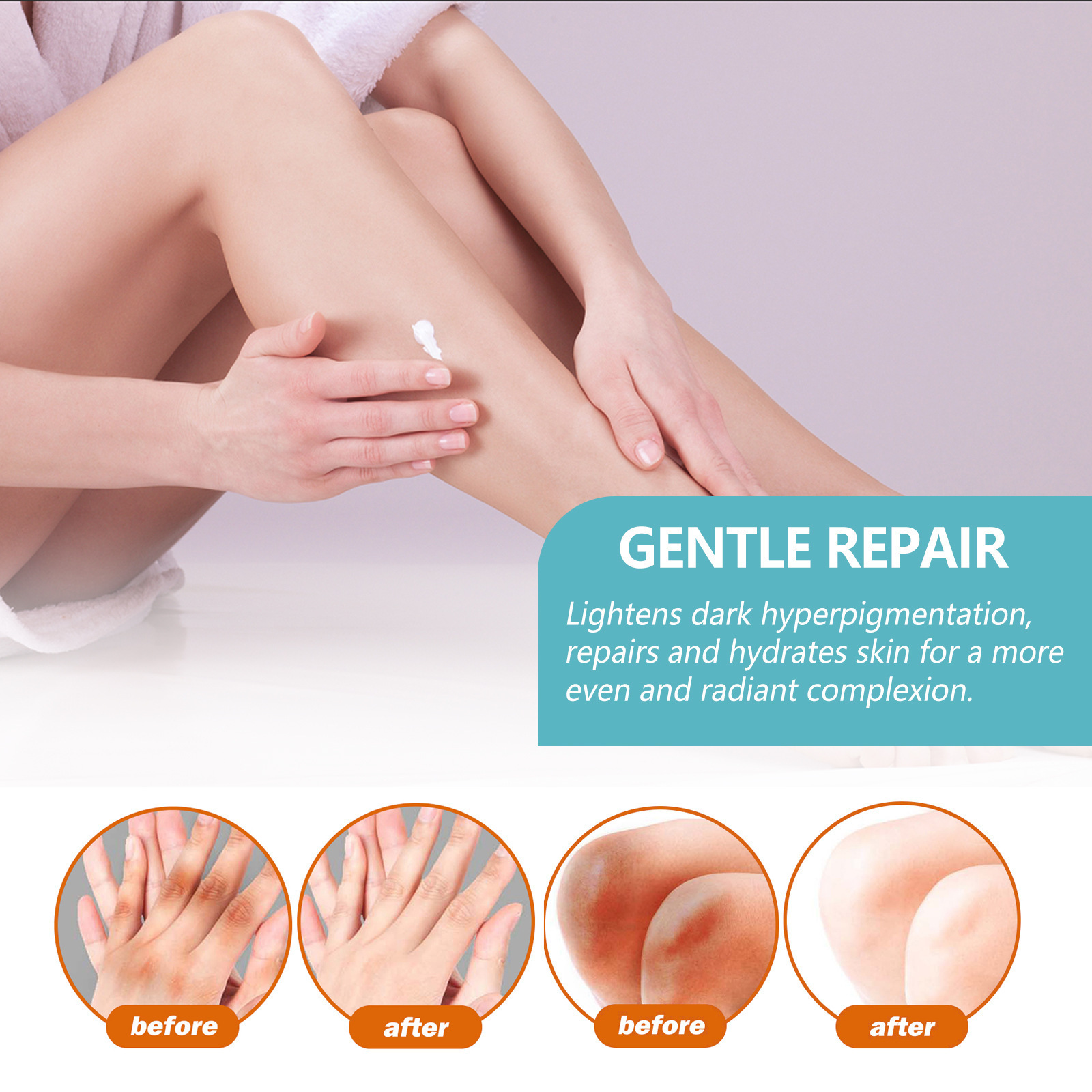 Black Scaly Skin Repair Cream - Moisturizing, Whitening and Repairing Cream for Underarms, Arms, Knees and Joints to Remove Dark Spots on the Body