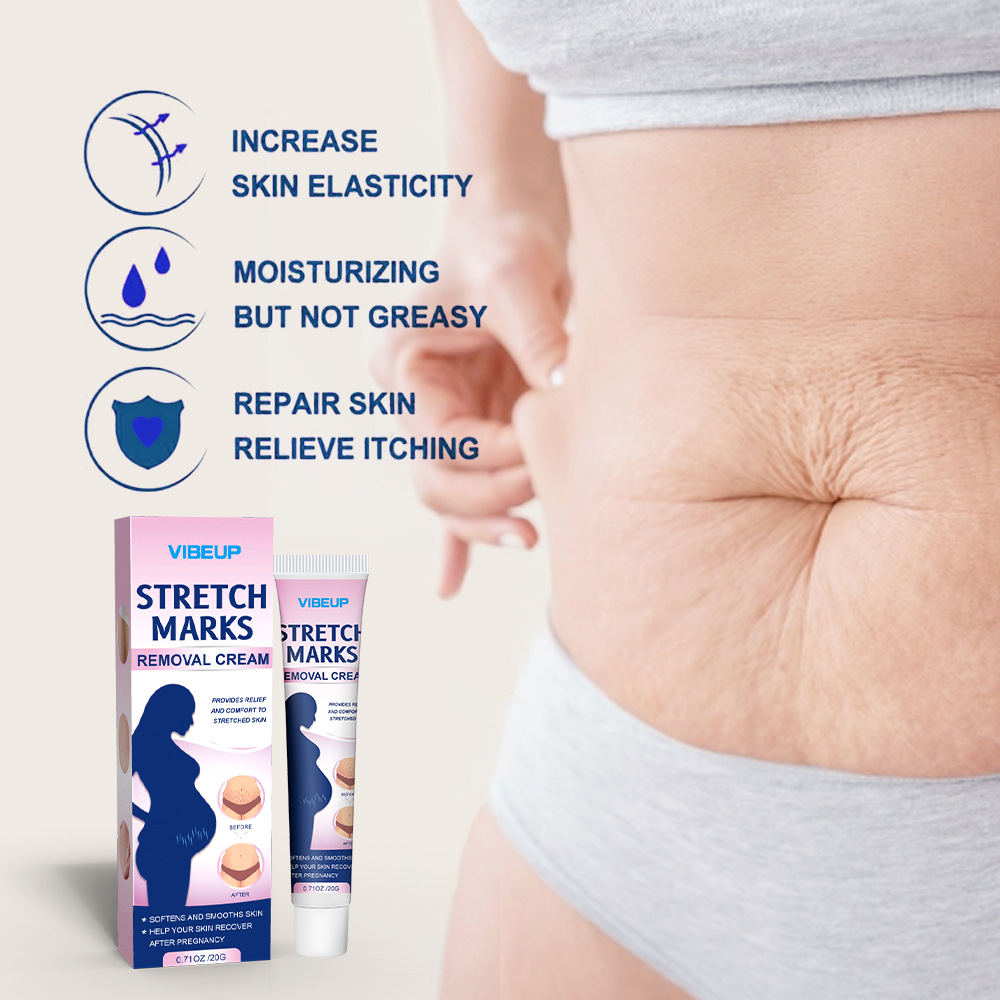 Cross-border stretch mark care cream - Body texture scar post-pregnancy care massage cream