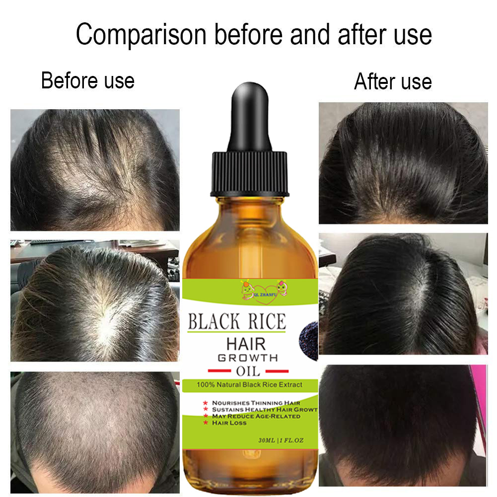 Hair Growth Serum Black Rice Rosemary for Hair Loss Treatment Bald Head Hair Regrowth Black Sesame Seeds Essence 30ml