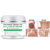 Crazylife 'Cracked Skin Repair Cream 100g 40% UREA CREAM