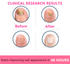 Blsex Nail Fungal Repair Serum Foot Toe Nail Fungus Removal Essential Oil Anti Infection Onychomycosis Paronychia Repairing Care
