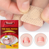Tonfly Ingrown Toenail Correction Tool Nail Filling Pad Ingrown Toe Nail Treatment Elastic Patch Straightening Clip Brace Pedicure Tool