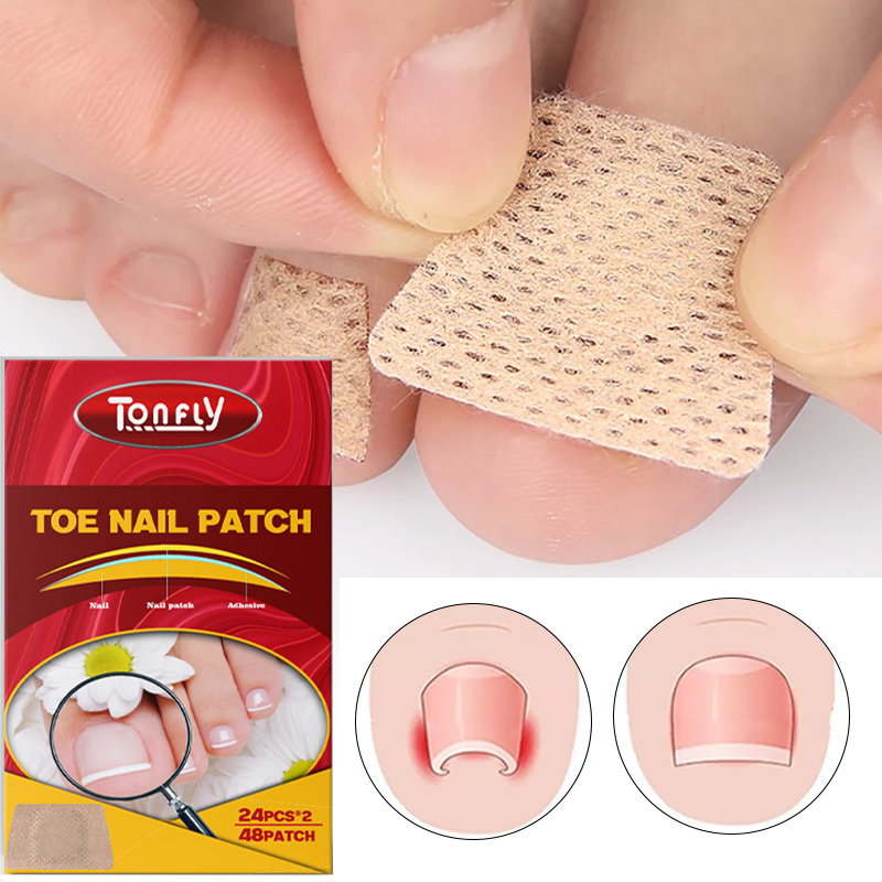 Tonfly Ingrown Toenail Correction Tool Nail Filling Pad Ingrown Toe Nail Treatment Elastic Patch Straightening Clip Brace Pedicure Tool