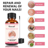 EDiE BAO Extra Strong Nail Fungus Treatment Serum Essence oil Repair Removal Fungal Feet Nails Care Toe Anti Infection Cream Essence