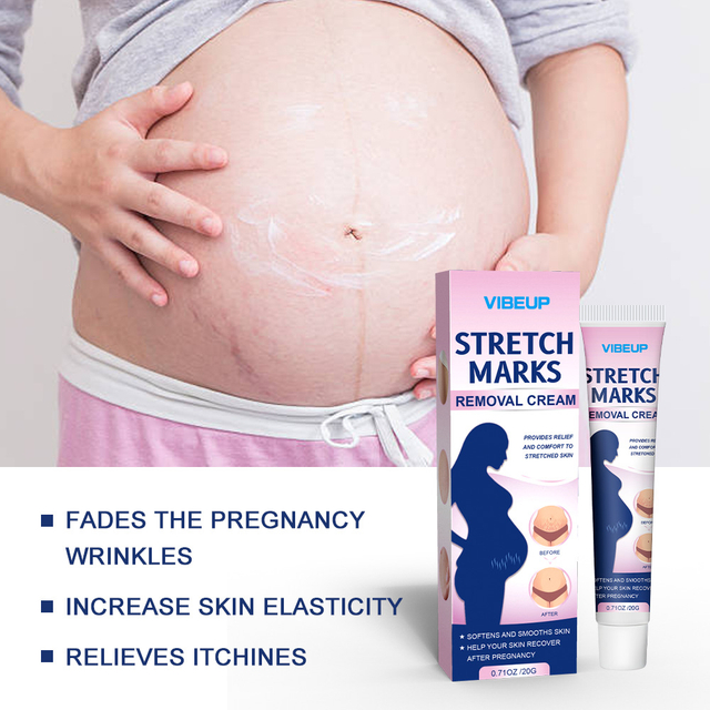 Cross-border stretch mark care cream - Body texture scar post-pregnancy care massage cream