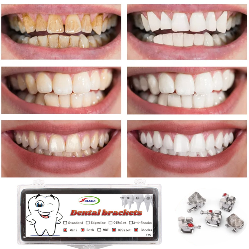 BLSEX Long box dental brackets dental material teeth correction