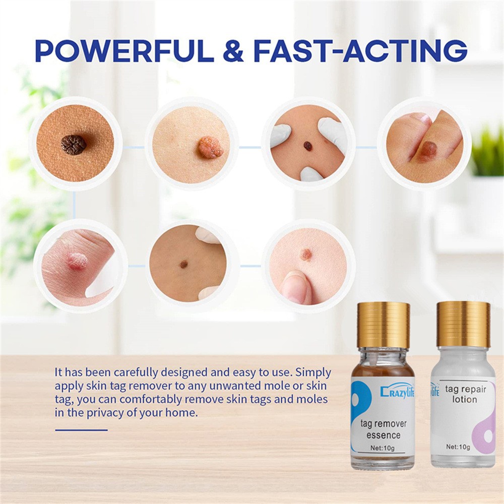 详情4