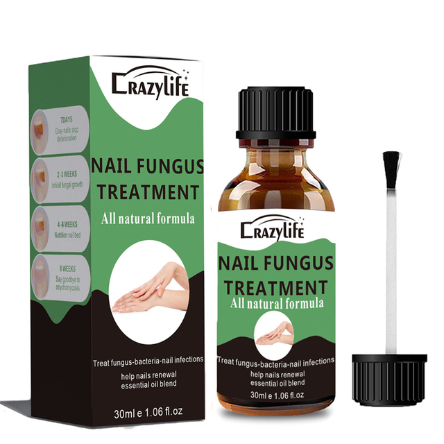 Crazylife Extra Strong Nail Fungus Treatment Serum Essence oil Repair Removal Fungal Feet Nails Care Toe Anti Infection Cream Essence