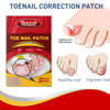 Tonfly Ingrown Toenail Correction Tool Nail Filling Pad Ingrown Toe Nail Treatment Elastic Patch Straightening Clip Brace Pedicure Tool