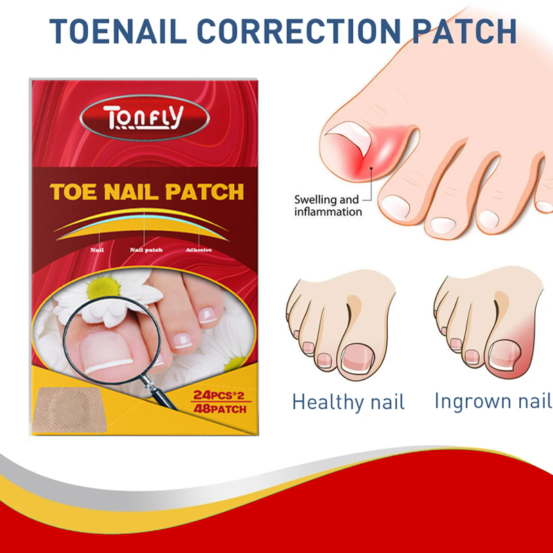 Tonfly Ingrown Toenail Correction Tool Nail Filling Pad Ingrown Toe Nail Treatment Elastic Patch Straightening Clip Brace Pedicure Tool