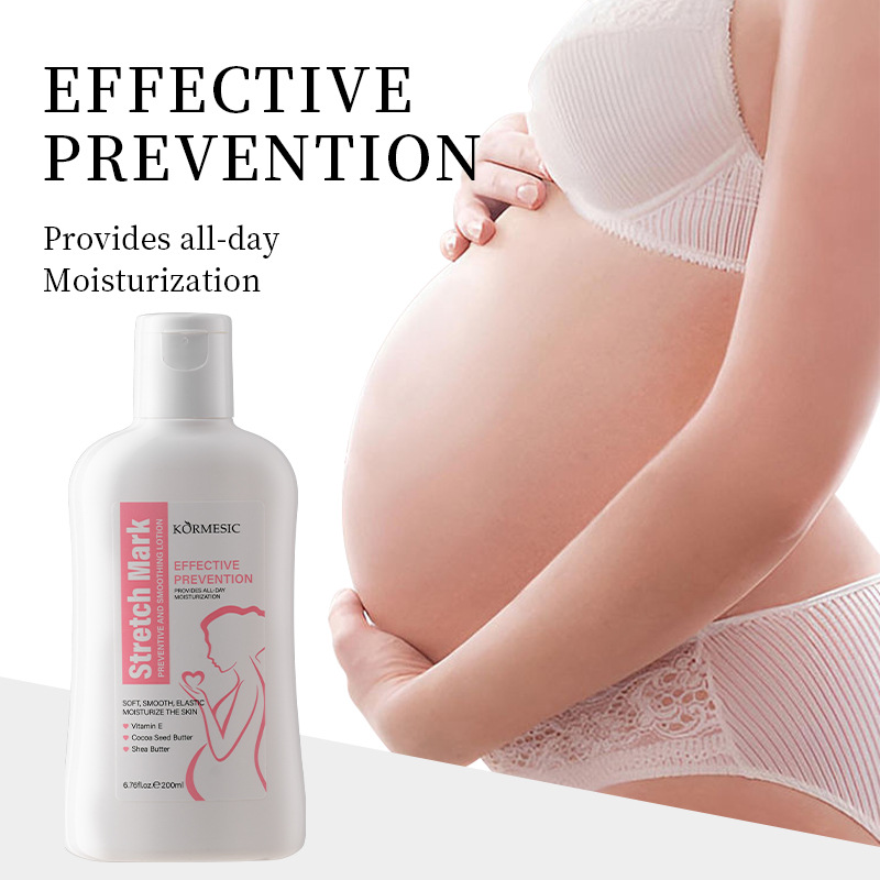 Stretch mark moisturizing body lotion