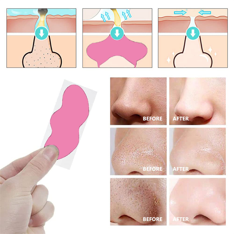 Charcoal & Tea Tree Nose Pore Strip - Blackhead Extractor Deep Cleans Non-Irritating