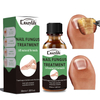 Crazylife Extra Strong Nail Fungus Treatment Serum Essence oil Repair Removal Fungal Feet Nails Care Toe Anti Infection Cream Essence