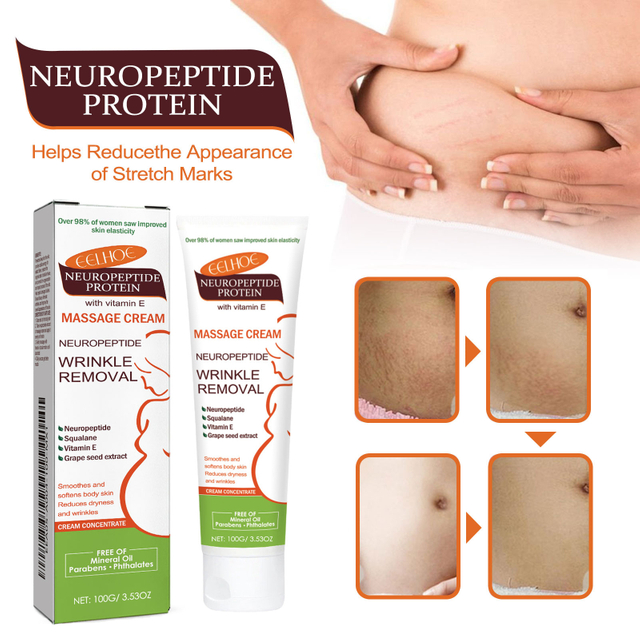 Neuropeptide Protein Massage Cream - Gentle and Moisturizing Body Care for Skin Protection and Smoothness - Massage Cream