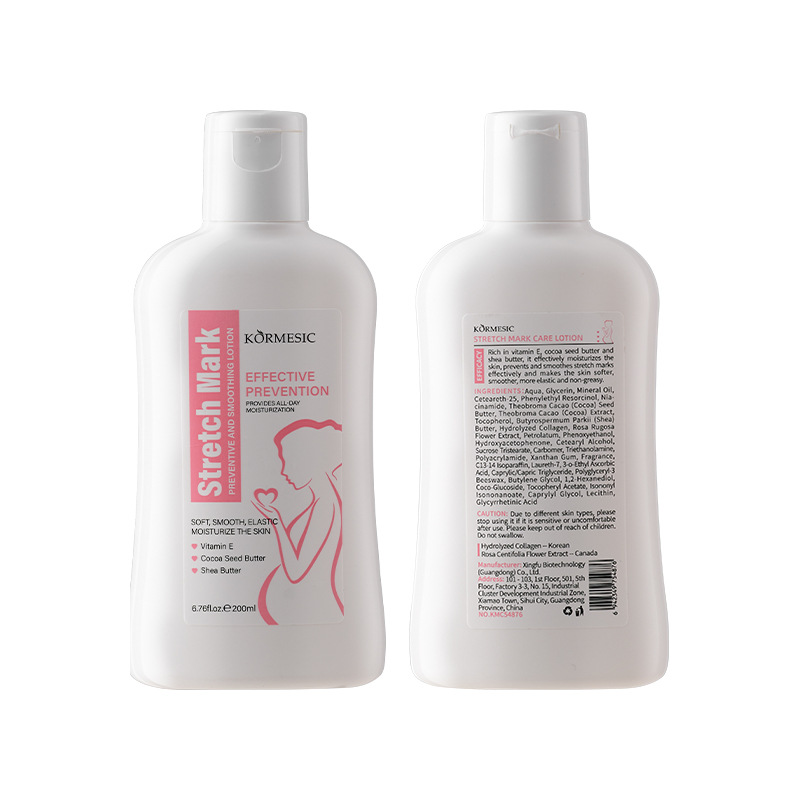 Stretch mark moisturizing body lotion
