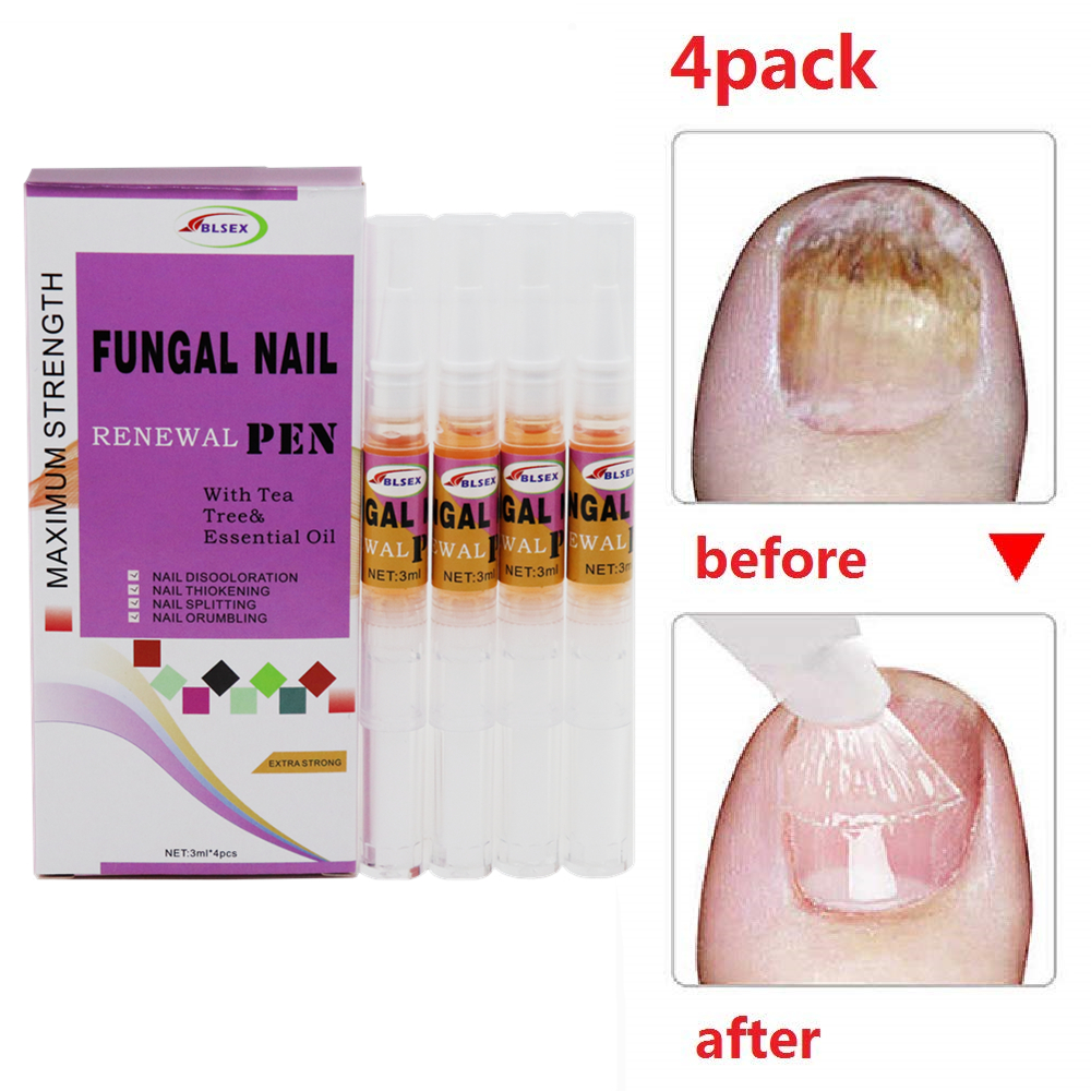 BLSEX 3ml*4 Nail Fungus Repair Essence Pen Repair Fingernail 25%Undecylenic Foot Nail Restores Care Of Appearance Discolored Tool