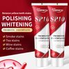 SP10 Probiotic Whitening Toothpaste