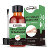 Crazylife Extra Strong Nail Fungus Treatment Serum Essence oil Repair Removal Fungal Feet Nails Care Toe Anti Infection Cream Essence